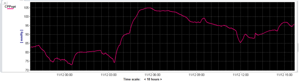  The CPPopt weighted multi-window trend line