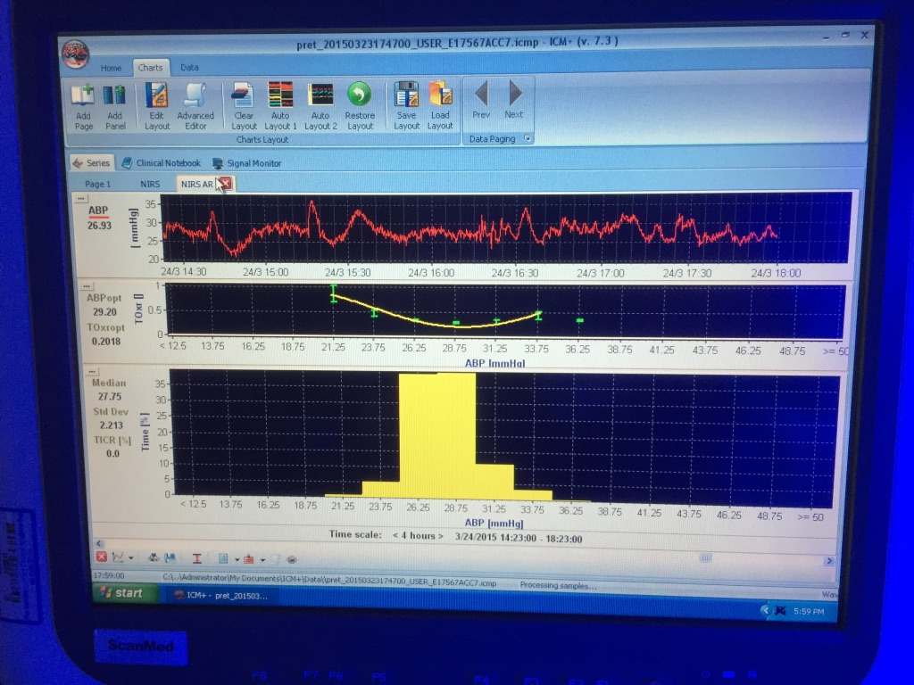 Cotside monitoring screen showing the time trend line for the arterial blood pressure (ABP) and the ABP-TOHRx error bar with fitted (U shape) curve