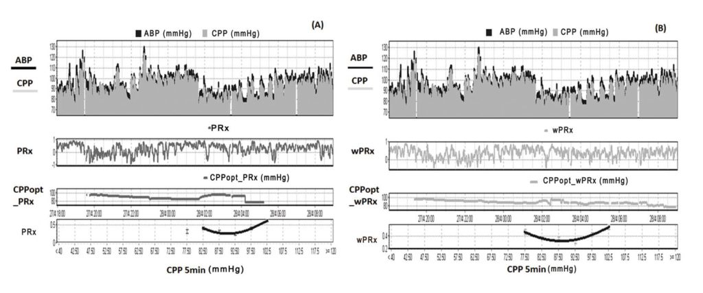 data analysis using ICM+, showing time trends of ABP, CPP, PRx and CPPopt.