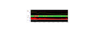 Optimal cerebral perfusion pressure treatment arm ICM+ monitoring